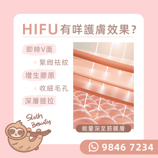 【KO包包面】韓國Hifu無針埋線Facial - Image 3